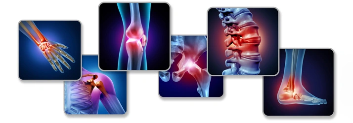X-ray images highlighting inflammation in various joints including wrist, knee, hip, spine, and ankle