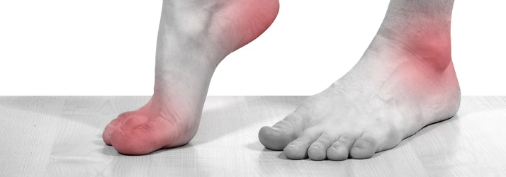 Feet and ankles with highlighted areas indicating pain or inflammation.